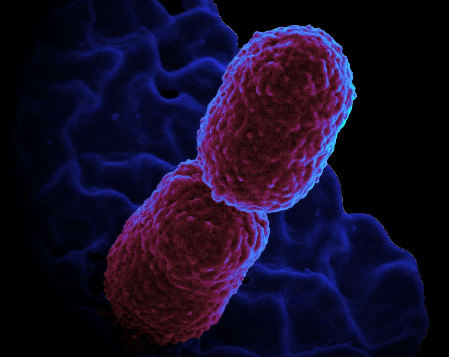 Klebsiella pneumoniae is an enterobacteria responsible for nosocomial infections of concern, as many cases of antibiotic resistance have been observed. © NIAID, Flickr, CC by 2.0