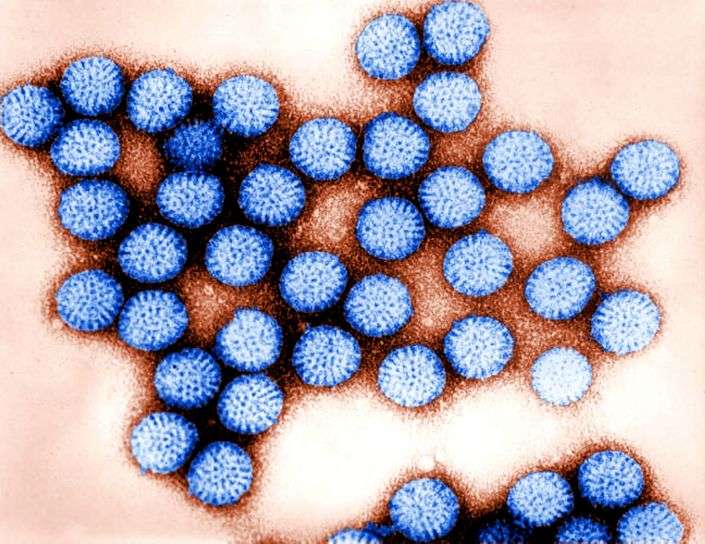 Noroviruses are responsible for many epidemics of gastroenteritis. © public-domain-image.com, DP