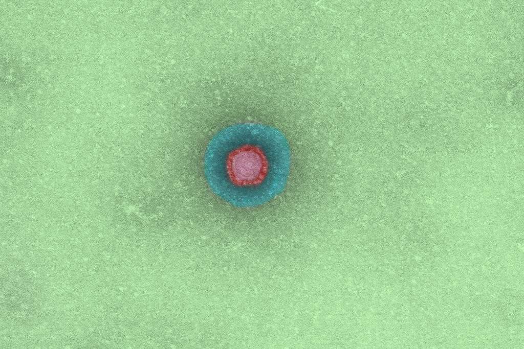 The Sars-CoV coronavirus. © Institut Pasteur